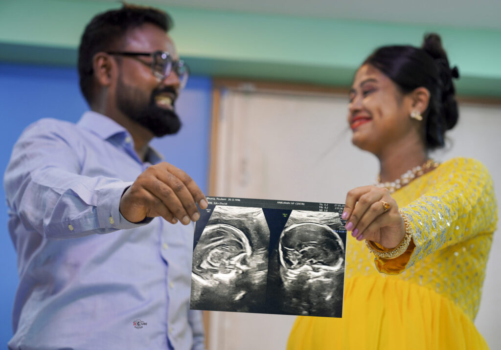 Maternity Photo with USG